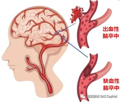 「心玮医疗」完成C轮融资，欧博官网资源独家财务照料 | 欧博官网生意